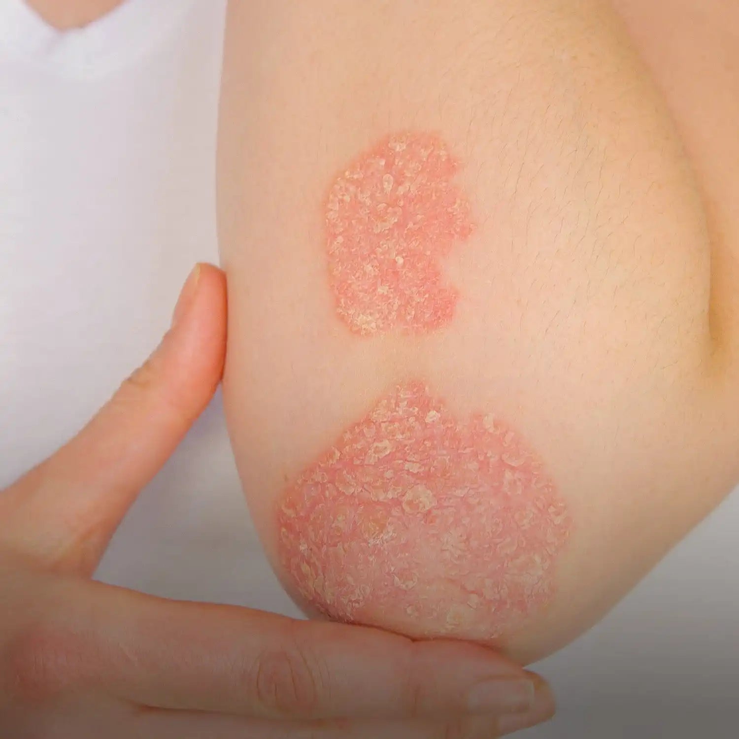 Pink peeling skin cream