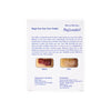Rejuvaskin Scar Fx Silicone Sheeting Breast Anchor