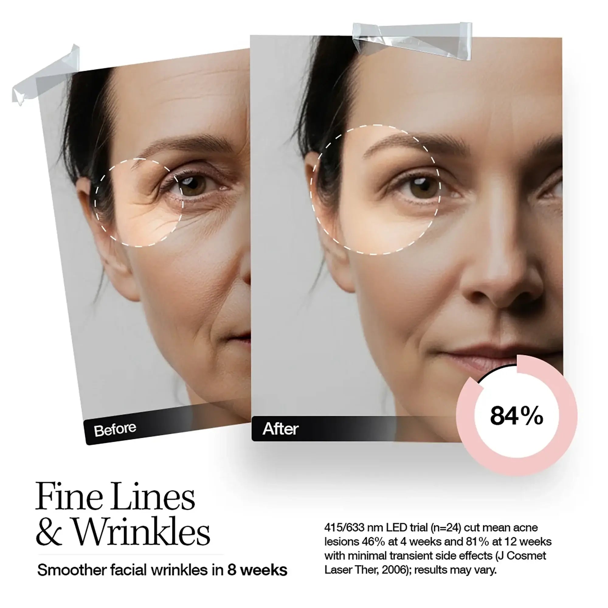 61464-Elle Led Mask Radiance Boost Pro Facewear Pink Colour +5