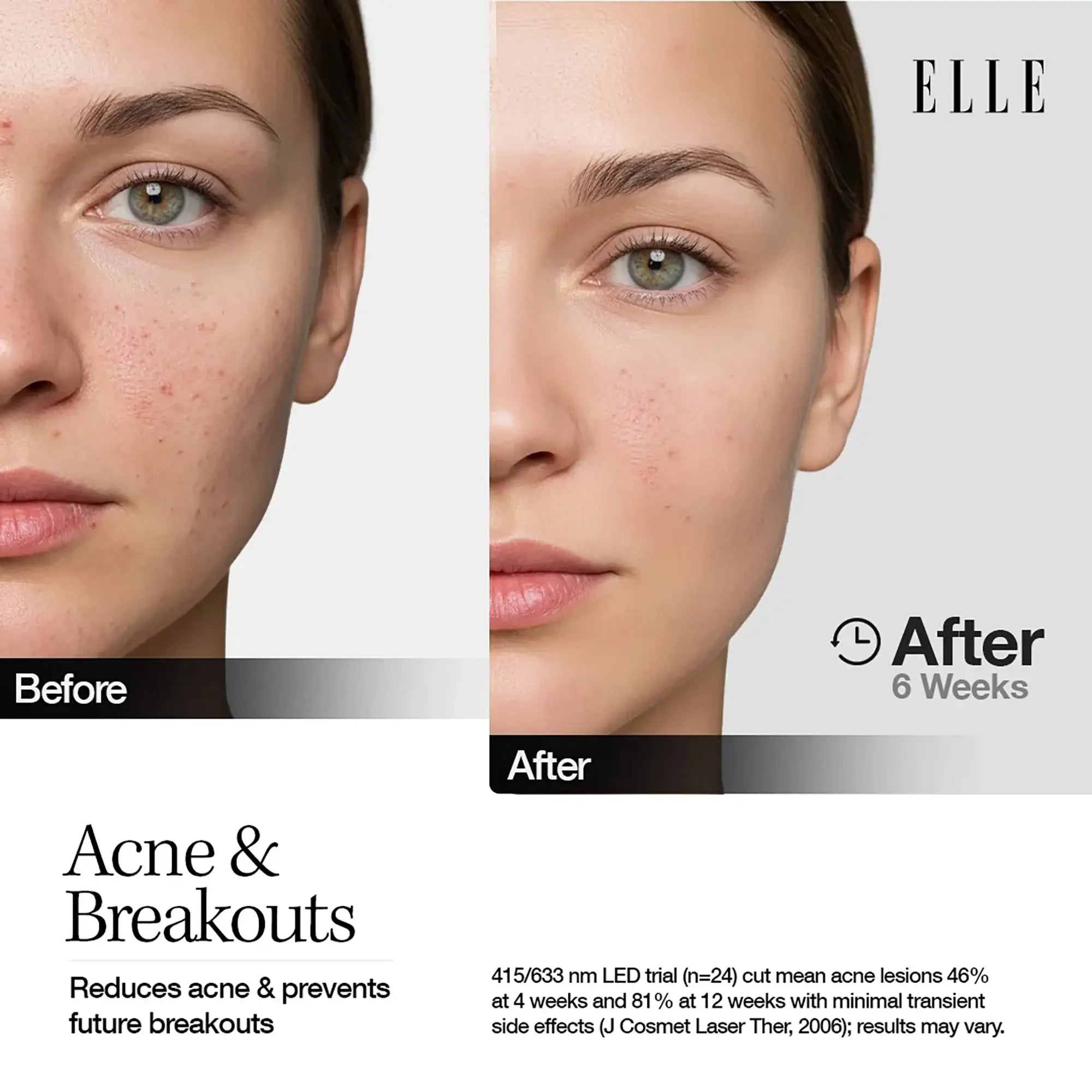 61464-Elle Led Mask Radiance Boost Pro Facewear Pink Colour +4