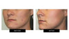 CURRENTBODY SKIN - Currentbody Skin Led Light Therapy Mask - Pharmazone - 