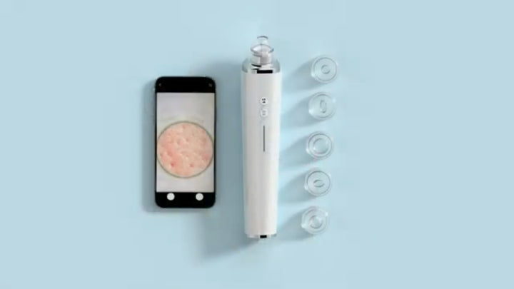 45769-Cozmo+ Intelligent Visual Blackhead Remover +4