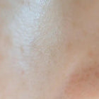 Close-up of human skin.