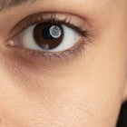 Human eye with dark circles.