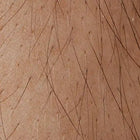 Human skin with hair follicles.