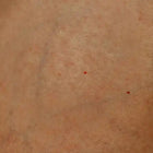 Human skin texture.